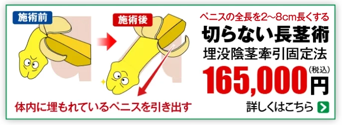 切らない長茎術 165000円