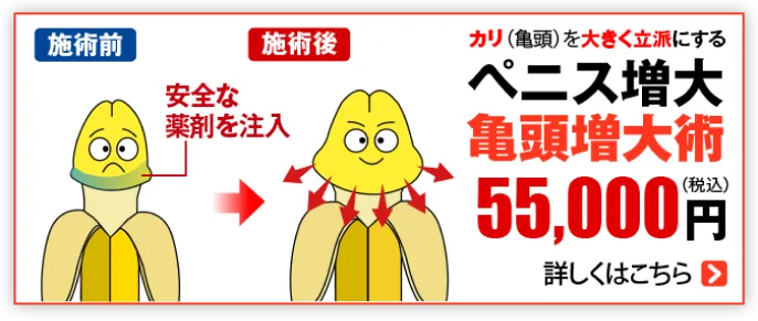 ペニス増大 亀頭増大術 55000円