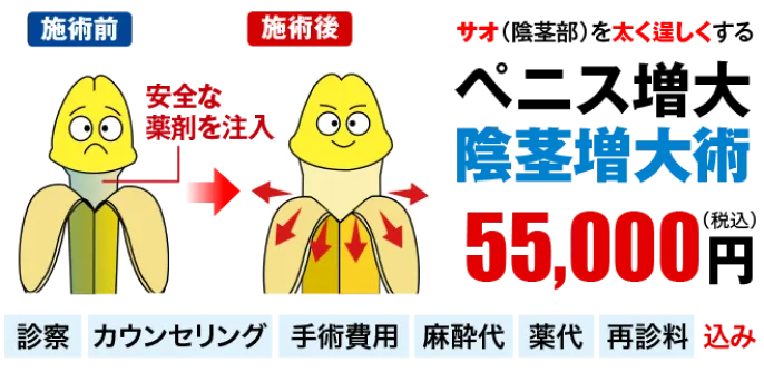 ペニス増大・陰茎増大術