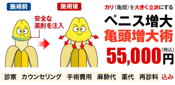 ペニス増大・亀頭増大術