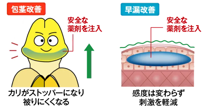 包茎の改善・早漏の改善効果