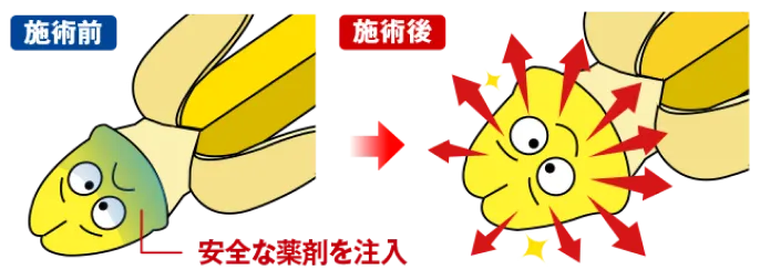 全体注入法