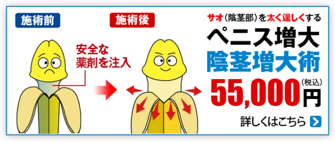 ペニス増大 陰茎増大術 55000円